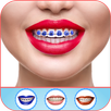 Braces Photo Editor 2023 APK