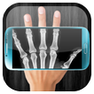 X-Ray Escáner (Broma - Prank)