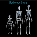 Radiology Signs