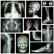 X-RAY Interpretation - cases