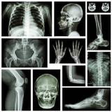 X RAY Interpretation - cases icono