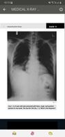 X-RAY Interpretation - cases captura de pantalla 3