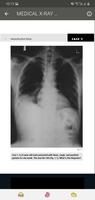 X-RAY Interpretation - cases capture d'écran 3