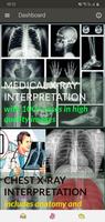 X-RAY Interpretation - cases Affiche