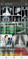 X-RAY Interpretation - cases Poster