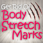 Get Rid of Body Stretch Marks icône