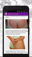 برنامه‌نما Get Rid of Body Stretch Marks عکس از صفحه