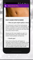 Get Rid of Body Stretch Marks capture d'écran 2