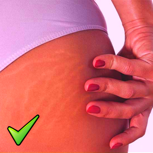 Get rid of STRETCH MARKS Natur