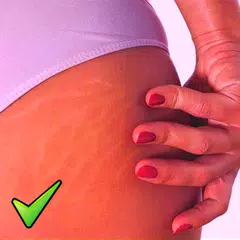 Get rid of STRETCH MARKS Natur アプリダウンロード