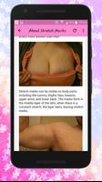 Get rid of STRETCH MARKS Natur скриншот 2