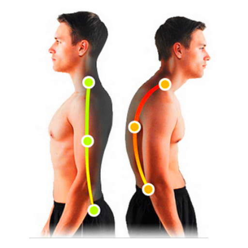 Posture Corrector - Tips to im