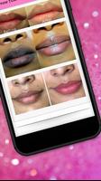 Lips Care - 13 Home Remedies T скриншот 2