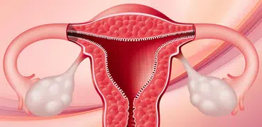 Polycystic Ovaries PCOS
