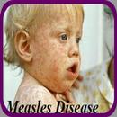 Measles Disease APK