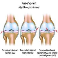 Knees Therapy screenshot 1