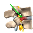 Herniated Disc Exercises icon