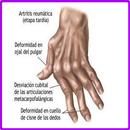 Remedios Caseros Artritis APK