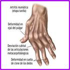 Remedios Caseros Artritis simgesi