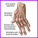 Remedios Caseros Artritis simgesi