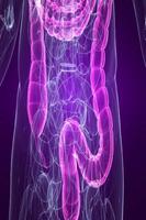 Irritable Bowel Syndrome - IBS screenshot 1