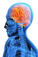 Chirurgie du cerveau capture d'écran 1