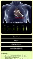 Poster Understand Heart Sounds And Murmurs