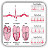 ECG / EKG Rhythm Step-by-Step  biểu tượng