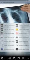 Chest X Ray - A Survival Guide bài đăng