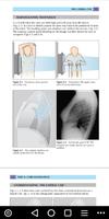 Chest X Ray - A Survival Guide ảnh chụp màn hình 2