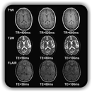 Overview of MRI Pulse Sequence APK