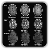 Overview of MRI Pulse Sequence icône