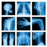 Medical X-Ray Interpretation 아이콘
