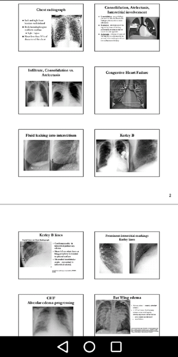 Medical X-Ray Interpretation screenshot 14