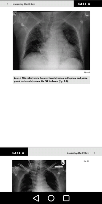 Medical X-Ray Interpretation screenshot 10