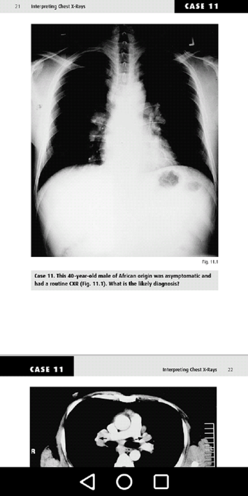 Medical X-Ray Interpretation screenshot 17