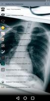 برنامه‌نما Medical X-Ray Interpretation عکس از صفحه