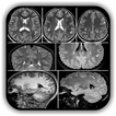 Imaging Brain, Skull & Cranioc