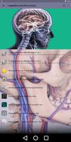 Imaging Brain, Skull & Cranioc ảnh chụp màn hình 1