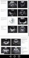 Gynecology - Ultrasound in Obs تصوير الشاشة 3