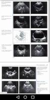 Gynecology - Ultrasound in Obs captura de pantalla 3