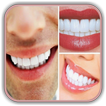 Teeth Whitening Tips: How to R