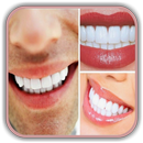 Teeth Whitening Tips: How to R APK