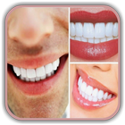 Teeth Whitening Tips: How to R biểu tượng