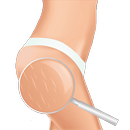 Stretch Marks Removal - Get Ri APK