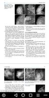 Oncoplastic and Reconstructive ảnh chụp màn hình 3
