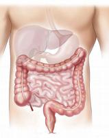 Colon Cancer ảnh chụp màn hình 1