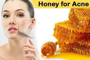 Home Remedies Using Honey Ekran Görüntüsü 1