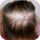 Hair Growth in Children APK