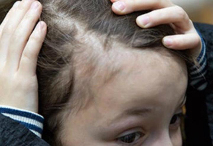 Hair Growth In Children For Android Apk Download